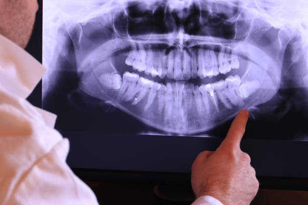 Best Emergency Root Canal Treatment in Elk Grove, CA